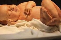 子宫内膜薄容易引起流产？能不能试管婴儿好孕？