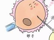 排卵障碍不容忽视，不孕大多是其原因！丽江市哪家医院擅长排卵障碍试管方案？