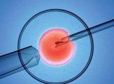 风疹病毒igg阳性与阴性怀孕并不难,提防假阳性是真