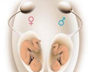 人工授精与试管婴儿技术的主要区别